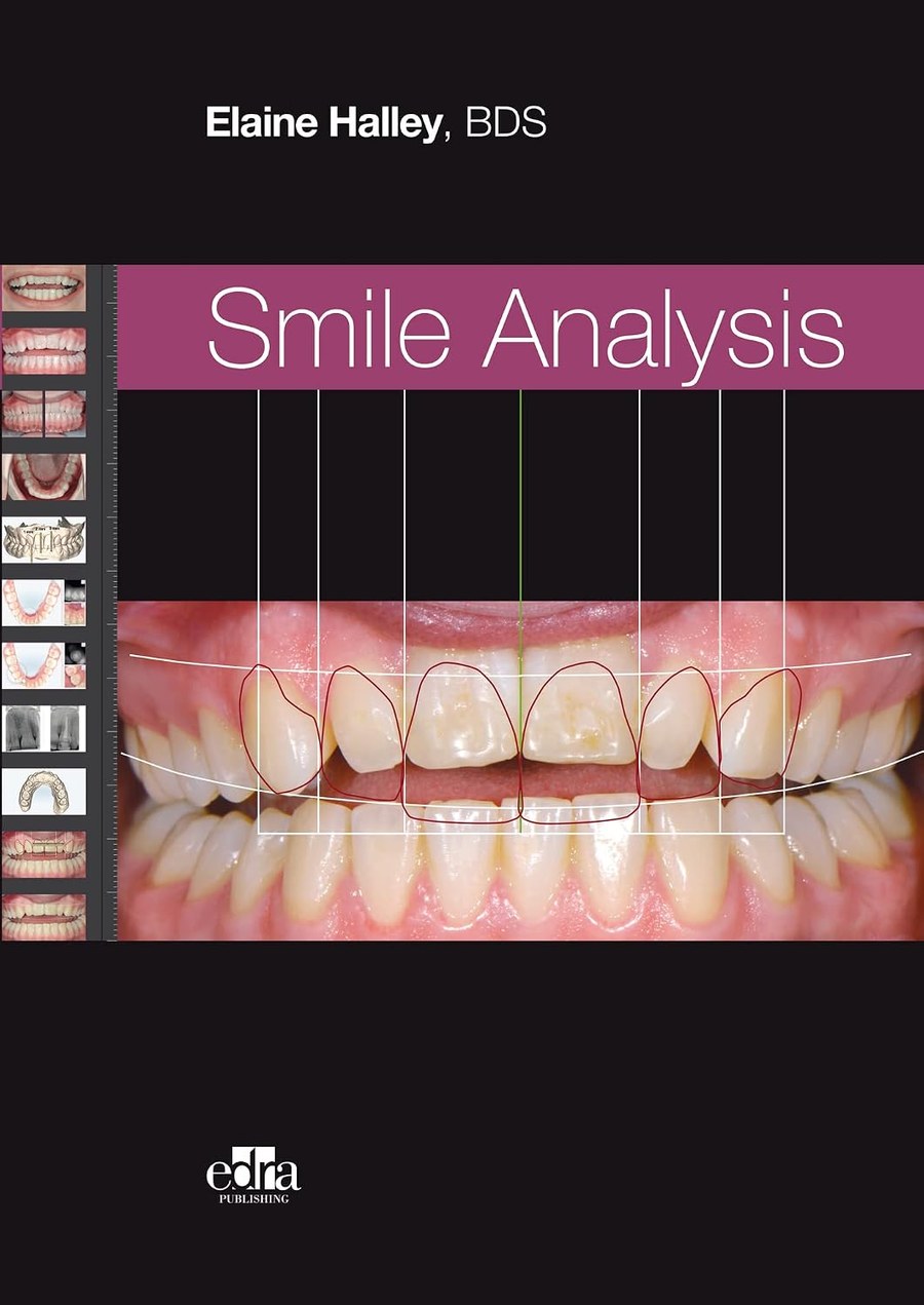 Smile Analysis by Dr Elaine Halley, published by EDRA